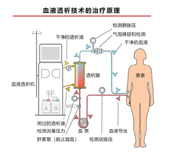 拟募集1351亿元“弃H回A”！威高旗下中国血透龙头企业冲击IPO(图4)